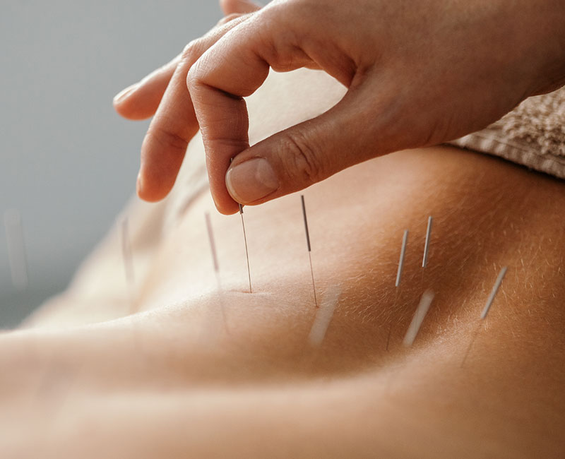 Acupuncrure + Ventouses (110$) + Consultation et Ouverture de dossier (25$) nouveau patient (1 heure 30 minutes) Acupuncrure + Ventouses (110$) + Consultation et Ouverture de dossier (25$) nouveau patient (1 heure 30 minutes)